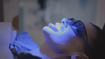 Zasłona do filmu "Des dents blanches... au rire jaune !" #774161