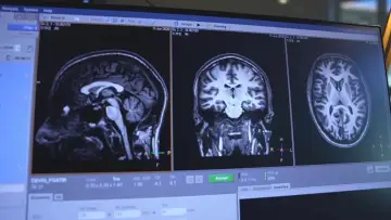 Zasłona do filmu "Migraine : la fin du casse-tête ?" #1915594