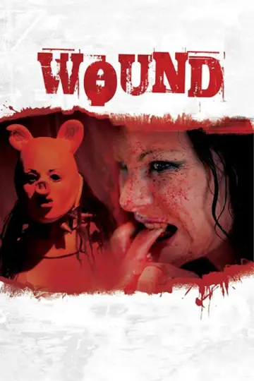 Wound