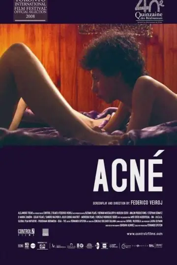 Plakat do filmu "Acné" #1171126