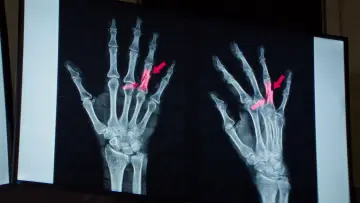 Zasłona do filmu "Anatomia upadku" #638719