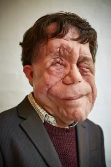 Zdjęcie Adam Pearson #135602