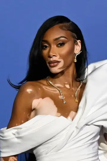 Zdjęcie  (Winnie Harlow) #155993