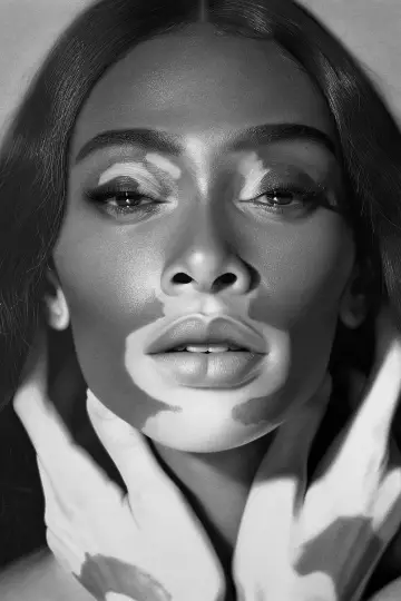 Zdjęcie  (Winnie Harlow) #155994