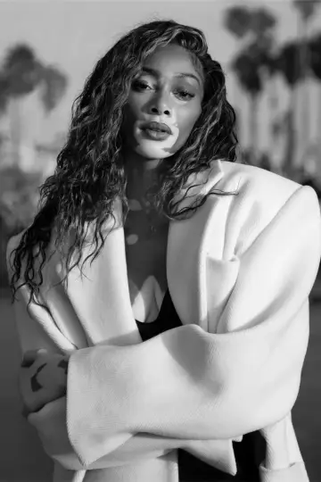 Zdjęcie  (Winnie Harlow) #155995
