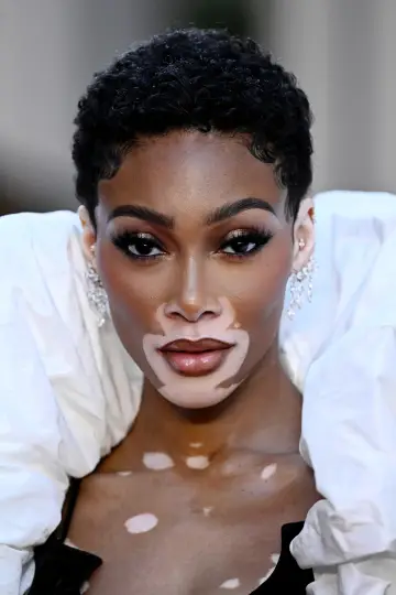 Zdjęcie  (Winnie Harlow) #330231