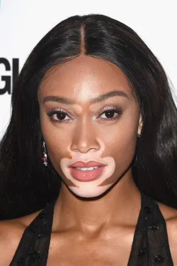 Zdjęcie  (Winnie Harlow) #330232