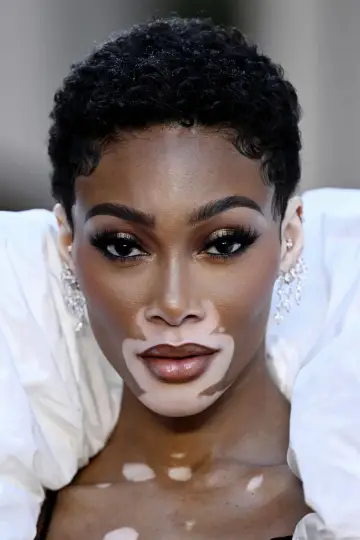 Zdjęcie  (Winnie Harlow) #330233