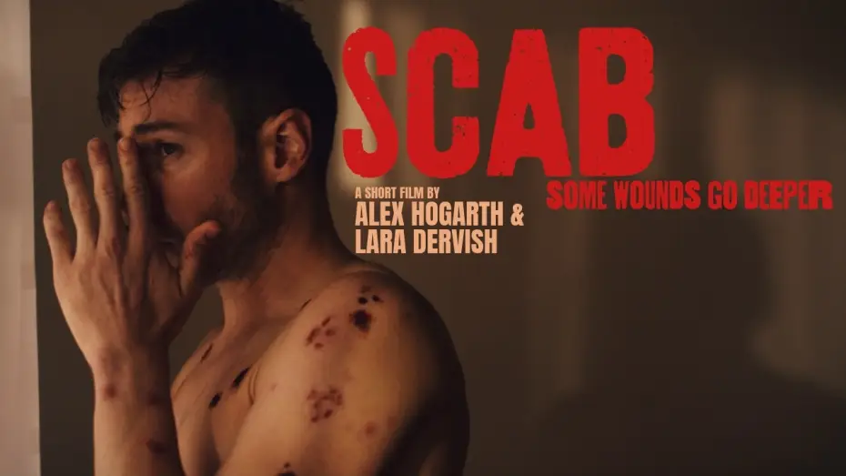 Wideo do filmu Scab — SCAB | Official Teaser | Body Horror